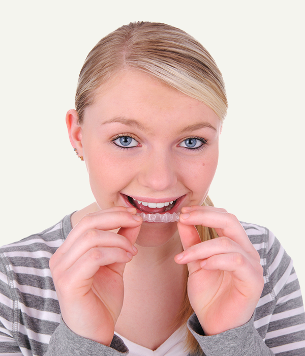 Clear Aligners image