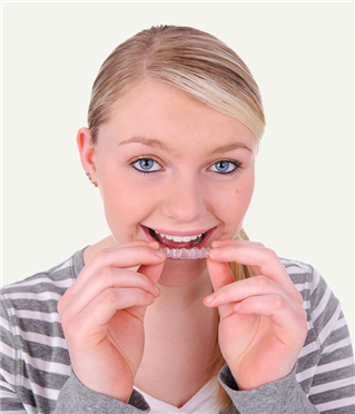 In House Aligners image